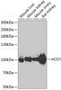 Western blot analysis of extracts of various cell lines, using ACO1 antibody (19-974) at 1:500 dilution.<br/>Secondary antibody: HRP Goat Anti-Rabbit IgG (H+L) at 1:10000 dilution.<br/>Lysates/proteins: 25ug per lane.<br/>Blocking buffer: 3% nonfat dry milk in TBST.<br/>Detection: ECL Basic Kit.<br/>Exposure time: 90s.