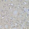 Immunohistochemistry of paraffin-embedded mouse brain using ACO1 antibody (19-974) (40x lens) .
