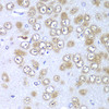 Immunohistochemistry of paraffin-embedded rat brain using RPS10 antibody (19-990) at dilution of 1:100 (40x lens) .