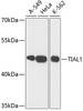 Western blot analysis of extracts of various cell lines, using TIAL1 antibody (19-997) at 1:3000 dilution.<br/>Secondary antibody: HRP Goat Anti-Rabbit IgG (H+L) at 1:10000 dilution.<br/>Lysates/proteins: 25ug per lane.<br/>Blocking buffer: 3% nonfat dry milk in TBST.<br/>Detection: ECL Basic Kit.<br/>Exposure time: 90s.