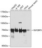 Western blot analysis of extracts of various cell lines, using IGF2BP3 antibody (22-006) at 1:1000 dilution.<br/>Secondary antibody: HRP Goat Anti-Rabbit IgG (H+L) at 1:10000 dilution.<br/>Lysates/proteins: 25ug per lane.<br/>Blocking buffer: 3% nonfat dry milk in TBST.<br/>Detection: ECL Basic Kit.<br/>Exposure time: 15s.