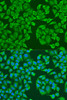 Immunofluorescence analysis of U2OS cells using IGF2BP3 antibody (22-006) at dilution of 1:100. Blue: DAPI for nuclear staining.