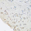 Immunohistochemistry of paraffin-embedded mouse brain using PUM1 antibody (22-010) at dilution of 1:100 (40x lens) .