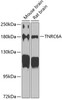 Western blot analysis of extracts of various cell lines, using TNRC6A antibody (22-011) at 1:1000 dilution.<br/>Secondary antibody: HRP Goat Anti-Rabbit IgG (H+L) at 1:10000 dilution.<br/>Lysates/proteins: 25ug per lane.<br/>Blocking buffer: 3% nonfat dry milk in TBST.<br/>Detection: ECL Basic Kit.<br/>Exposure time: 90s.