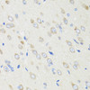 Immunohistochemistry of paraffin-embedded rat brain using CRABP2 antibody (22-012) at dilution of 1:100 (40x lens) .