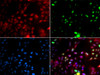 Immunofluorescence analysis of GFP-RNF168 transgenic U2OS cells using POLK antibody (22-014) . Green：GFP-RNF168 fusion protein expression for DNA damage marker.Blue: DAPI for nuclear staining.RNF168 (GFP) can be used to mark cells damaged by UV-A laser for they always gather around DNA damage region.