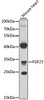 Western blot analysis of extracts of mouse heart, using FGF23 antibody (22-015) at 1:1000 dilution.<br/>Secondary antibody: HRP Goat Anti-Rabbit IgG (H+L) at 1:10000 dilution.<br/>Lysates/proteins: 25ug per lane.<br/>Blocking buffer: 3% nonfat dry milk in TBST.<br/>Detection: ECL Enhanced Kit.<br/>Exposure time: 40s.