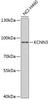 Western blot analysis of extracts of NCI-H460 cells, using KCNN3 antibody (22-016) at 1:1000 dilution.<br/>Secondary antibody: HRP Goat Anti-Rabbit IgG (H+L) at 1:10000 dilution.<br/>Lysates/proteins: 25ug per lane.<br/>Blocking buffer: 3% nonfat dry milk in TBST.<br/>Detection: ECL Enhanced Kit.<br/>Exposure time: 60s.