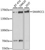 Western blot analysis of extracts of various cell lines, using SMARCC1 antibody (22-018) at 1:1000 dilution.<br/>Secondary antibody: HRP Goat Anti-Rabbit IgG (H+L) at 1:10000 dilution.<br/>Lysates/proteins: 25ug per lane.<br/>Blocking buffer: 3% nonfat dry milk in TBST.<br/>Detection: ECL Basic Kit.<br/>Exposure time: 120s.