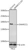 Western blot analysis of extracts from normal (control) and SMARCC1 knockout (KO) HeLa cells, using SMARCC1 antibody (22-018) at 1:1000 dilution.<br/>Secondary antibody: HRP Goat Anti-Rabbit IgG (H+L) at 1:10000 dilution.<br/>Lysates/proteins: 25ug per lane.<br/>Blocking buffer: 3% nonfat dry milk in TBST.<br/>Detection: ECL Basic Kit.<br/>Exposure time: 15s.