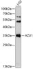 Western blot analysis of extracts of LO2 cells, using AZU1 Antibody (22-022) at 1:1000 dilution.<br/>Secondary antibody: HRP Goat Anti-Rabbit IgG (H+L) at 1:10000 dilution.<br/>Lysates/proteins: 25ug per lane.<br/>Blocking buffer: 3% nonfat dry milk in TBST.<br/>Detection: ECL Basic Kit.<br/>Exposure time: 1s.