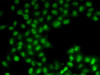 Immunofluorescence analysis of U2OS cells using C11orf30 antibody (22-024) .