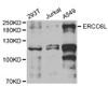 Western blot analysis of extracts of various cell lines, using ERCC6L antibody (22-025) at 1:1000 dilution.<br/>Secondary antibody: HRP Goat Anti-Rabbit IgG (H+L) at 1:10000 dilution.<br/>Lysates/proteins: 25ug per lane.<br/>Blocking buffer: 3% nonfat dry milk in TBST.<br/>Detection: ECL Basic Kit.<br/>Exposure time: 90s.