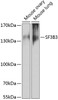 Western blot analysis of extracts of various cell lines, using SF3B3 antibody (22-031) at 1:1000 dilution.<br/>Secondary antibody: HRP Goat Anti-Rabbit IgG (H+L) at 1:10000 dilution.<br/>Lysates/proteins: 25ug per lane.<br/>Blocking buffer: 3% nonfat dry milk in TBST.<br/>Detection: ECL Enhanced Kit.