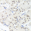 Immunohistochemistry of paraffin-embedded human stomach using HMGN1 antibody (22-035) at dilution of 1:100 (40x lens) .