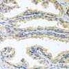 Immunohistochemistry of paraffin-embedded human prostate using OSM antibody (22-037) at dilution of 1:100 (40x lens) .