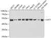 Western blot analysis of extracts of various cell lines, using HAT1 antibody (22-046) at 1:1000 dilution.<br/>Secondary antibody: HRP Goat Anti-Rabbit IgG (H+L) at 1:10000 dilution.<br/>Lysates/proteins: 25ug per lane.<br/>Blocking buffer: 3% nonfat dry milk in TBST.<br/>Detection: ECL Basic Kit.<br/>Exposure time: 30s.