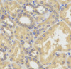 Immunohistochemistry of paraffin-embedded human kidney using SMYD5 antibody (22-047) .