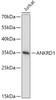 Western blot analysis of extracts of Jurkat cells, using ANKRD1 antibody (22-048) at 1:1000 dilution.<br/>Secondary antibody: HRP Goat Anti-Rabbit IgG (H+L) at 1:10000 dilution.<br/>Lysates/proteins: 25ug per lane.<br/>Blocking buffer: 3% nonfat dry milk in TBST.<br/>Detection: ECL Basic Kit.<br/>Exposure time: 5s.