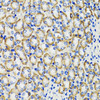 Immunohistochemistry of paraffin-embedded rat kidney using COMT antibody (22-051) at dilution of 1:100 (40x lens) .