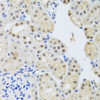 Immunohistochemistry of paraffin-embedded mouse kidney using SET antibody (22-055) at dilution of 1:100 (40x lens) .