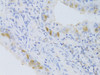 Immunohistochemistry of paraffin-embedded mouse lung using CYP2C9 Antibody (22-059) at dilution of 1:100 (40x lens) .