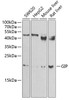 Western blot analysis of extracts of various cell lines, using GIP antibody (22-068) at 1:1000 dilution._Secondary antibody: HRP Goat Anti-Rabbit IgG (H+L) at 1:10000 dilution._Lysates/proteins: 25ug per lane._Blocking buffer: 3% nonfat dry milk in TBST._Detection: ECL Enhanced Kit._Exposure time: 60s.