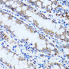 Immunohistochemistry of paraffin-embedded rat kidney using GIP antibody (22-068) at dilution of 1:100 (40x lens) .