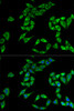 Immunofluorescence analysis of HeLa cells using PHLDA2 antibody (22-077) . Blue: DAPI for nuclear staining.