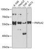 Western blot analysis of extracts of various cell lines, using PNPLA2 antibody (22-078) at 1:1000 dilution.<br/>Secondary antibody: HRP Goat Anti-Rabbit IgG (H+L) at 1:10000 dilution.<br/>Lysates/proteins: 25ug per lane.<br/>Blocking buffer: 3% nonfat dry milk in TBST.<br/>Detection: ECL Basic Kit.<br/>Exposure time: 30s.