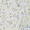 Immunohistochemistry of paraffin-embedded rat brain using GAB1 antibody (22-081) at dilution of 1:100 (40x lens) .