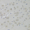 Immunohistochemistry of paraffin-embedded rat brain using HSD17B13 Antibody (22-087) at dilution of 1:100 (40x lens) .