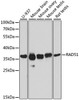 Western blot analysis of extracts of various cell lines, using RAD51 antibody (22-093) at 1:1000 dilution.<br/>Secondary antibody: HRP Goat Anti-Rabbit IgG (H+L) at 1:10000 dilution.<br/>Lysates/proteins: 25ug per lane.<br/>Blocking buffer: 3% nonfat dry milk in TBST.<br/>Detection: ECL Basic Kit.<br/>Exposure time: 30s.