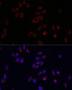 Immunofluorescence analysis of HeLa cells using PLIN2 antibody (22-096) at dilution of 1:100. Blue: DAPI for nuclear staining.