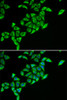 Immunofluorescence analysis of HeLa cells using DLAT antibody (22-102) . Blue: DAPI for nuclear staining.