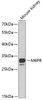 Western blot analysis of extracts of mouse kidney, using M6PR antibody (22-107) at 1:1000 dilution.<br/>Secondary antibody: HRP Goat Anti-Rabbit IgG (H+L) at 1:10000 dilution.<br/>Lysates/proteins: 25ug per lane.<br/>Blocking buffer: 3% nonfat dry milk in TBST.<br/>Detection: ECL Basic Kit.<br/>Exposure time: 40s.