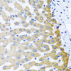 Immunohistochemistry of paraffin-embedded human liver damage using M6PR antibody (22-107) at dilution of 1:100 (40x lens) .