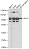 Western blot analysis of extracts of various cell lines, using RARS antibody (22-116) at 1:1000 dilution._Secondary antibody: HRP Goat Anti-Rabbit IgG (H+L) at 1:10000 dilution._Lysates/proteins: 25ug per lane._Blocking buffer: 3% nonfat dry milk in TBST._Detection: ECL Enhanced Kit._Exposure time: 30s.