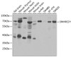 Western blot analysis of extracts of various cell lines, using SMARCD1 antibody (22-119) at 1:1000 dilution.<br/>Secondary antibody: HRP Goat Anti-Rabbit IgG (H+L) at 1:10000 dilution.<br/>Lysates/proteins: 25ug per lane.<br/>Blocking buffer: 3% nonfat dry milk in TBST.<br/>Detection: ECL Enhanced Kit.<br/>Exposure time: 30s.