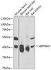 Western blot analysis of extracts of various cell lines, using SERPINA7 antibody (22-122) at 1:1000 dilution._Secondary antibody: HRP Goat Anti-Rabbit IgG (H+L) at 1:10000 dilution._Lysates/proteins: 25ug per lane._Blocking buffer: 3% nonfat dry milk in TBST._Detection: ECL Enhanced Kit._Exposure time: 30s.