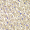 Immunohistochemistry of paraffin-embedded human liver damage using TXNL1 antibody (22-127) at dilution of 1:100 (40x lens) .