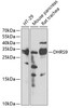 Western blot analysis of extracts of various cell lines, using DHRS9 antibody (22-128) at 1:3000 dilution._Secondary antibody: HRP Goat Anti-Rabbit IgG (H+L) at 1:10000 dilution._Lysates/proteins: 25ug per lane._Blocking buffer: 3% nonfat dry milk in TBST._Detection: ECL Enhanced Kit._Exposure time: 60s.