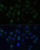 Immunofluorescence analysis of C6 cells using ZWINT Polyclonal Antibody (22-131) at dilution of 1:100 (40x lens) . Blue: DAPI for nuclear staining.