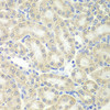 Immunohistochemistry of paraffin-embedded mouse kidney using PRDX5 antibody (22-132) at dilution of 1:200 (40x lens) .