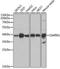 Western blot analysis of extracts of various cell lines, using CIAPIN1 antibody (22-138) at 1:1000 dilution.<br/>Secondary antibody: HRP Goat Anti-Rabbit IgG (H+L) at 1:10000 dilution.<br/>Lysates/proteins: 25ug per lane.<br/>Blocking buffer: 3% nonfat dry milk in TBST.<br/>Detection: ECL Basic Kit.<br/>Exposure time: 10s.