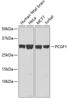 Western blot analysis of extracts of various cell lines, using PCGF1 antibody (22-140) .<br/>Secondary antibody: HRP Goat Anti-Rabbit IgG (H+L) at 1:10000 dilution.<br/>Lysates/proteins: 25ug per lane.<br/>Blocking buffer: 3% nonfat dry milk in TBST.