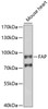 Western blot analysis of extracts of mouse heart, using FAP antibody (22-146) at 1:1000 dilution.<br/>Secondary antibody: HRP Goat Anti-Rabbit IgG (H+L) at 1:10000 dilution.<br/>Lysates/proteins: 25ug per lane.<br/>Blocking buffer: 3% nonfat dry milk in TBST.<br/>Detection: ECL Basic Kit.<br/>Exposure time: 30s.