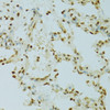 Immunohistochemistry of paraffin-embedded rat lung using RCC1 antibody (22-147) at dilution of 1:100 (40x lens) .