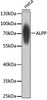 Western blot analysis of extracts of HeLa cells, using ALPP antibody (22-150) at 1:1000 dilution.<br/>Secondary antibody: HRP Goat Anti-Rabbit IgG (H+L) at 1:10000 dilution.<br/>Lysates/proteins: 25ug per lane.<br/>Blocking buffer: 3% nonfat dry milk in TBST.<br/>Detection: ECL Basic Kit.<br/>Exposure time: 1s.