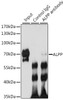 Immunoprecipitation analysis of 200ug extracts of HeLa cells, using 3 ug ALPP antibody (22-150) . Western blot was performed from the immunoprecipitate using ALPP antibody (22-150) at a dilition of 1:1000.